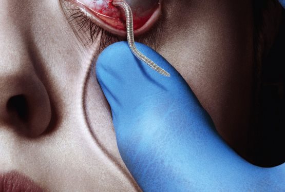 The Strain
